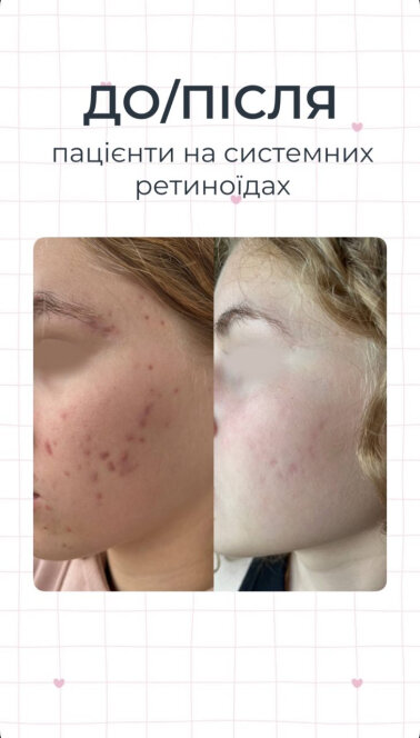 Результаты — Фото 6