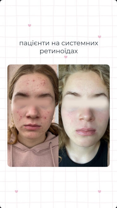 Результаты — Фото 7